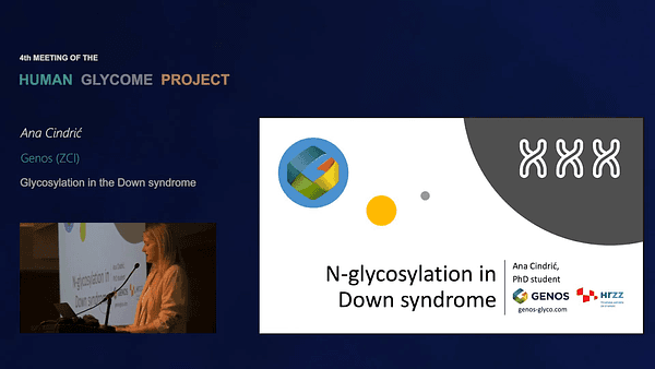 Glycosylation in the Down syndrome